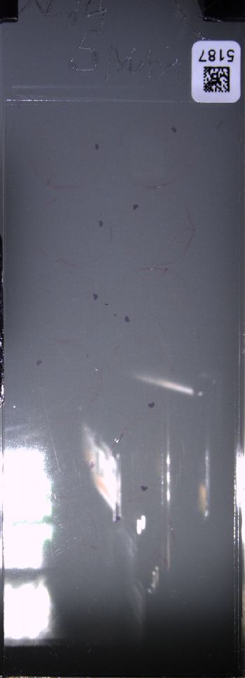 Media type: image; Special Collections 4011   shows specimen_part histological serial section;